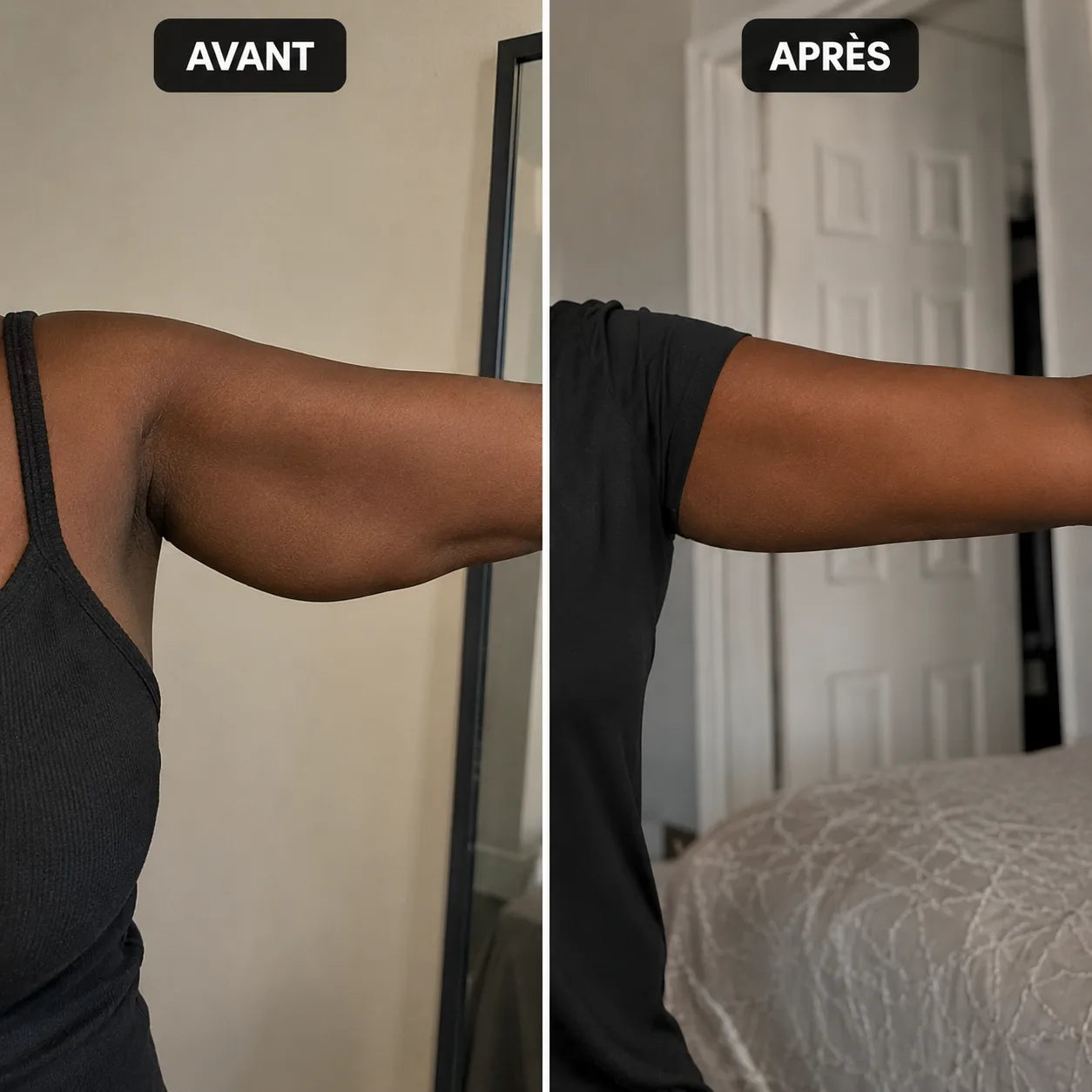 Avant après manchette Belnya 3