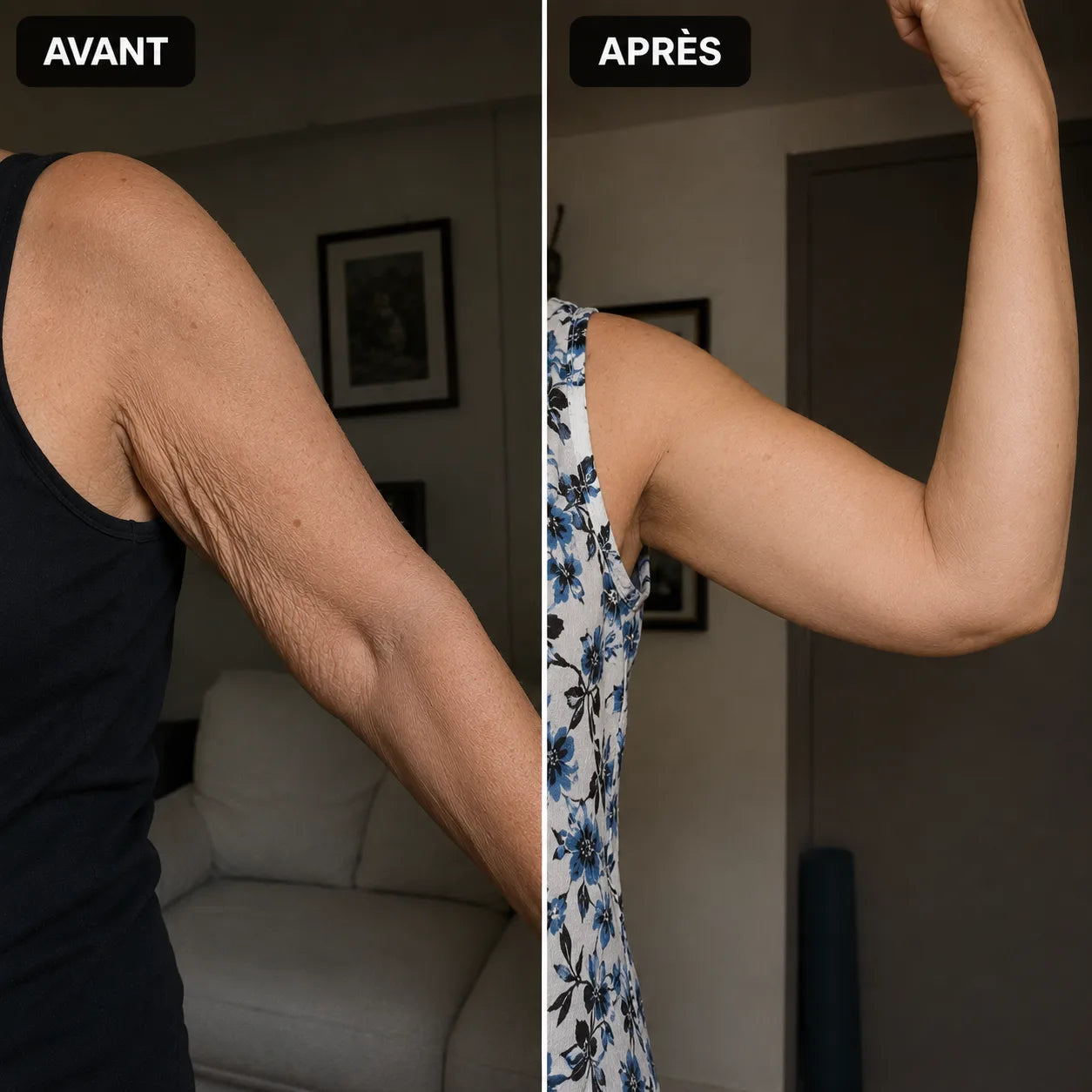 Avant après manchette Belnya 5